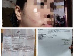 Naldy Kampar Resmi Dilaporkan ke Polisi atas Dugaan Penganiayaan AN